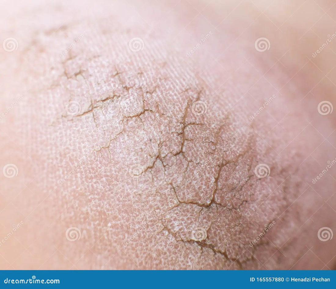 Barrier Care 2.0: 5 Signals Indie Brands Should Read Before Launching Their Recovery Cream